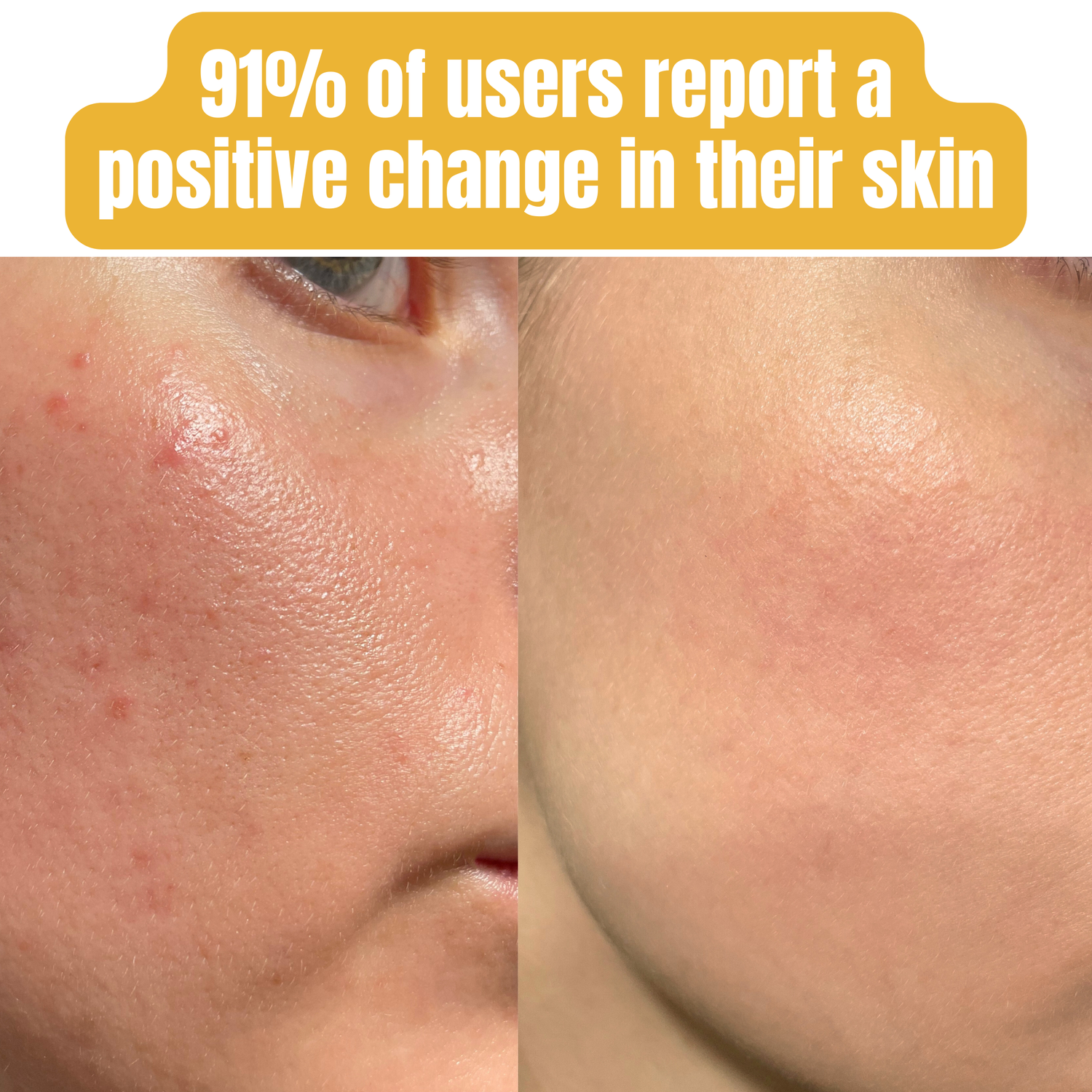 Vanilla Bean Whipped Beef Tallow