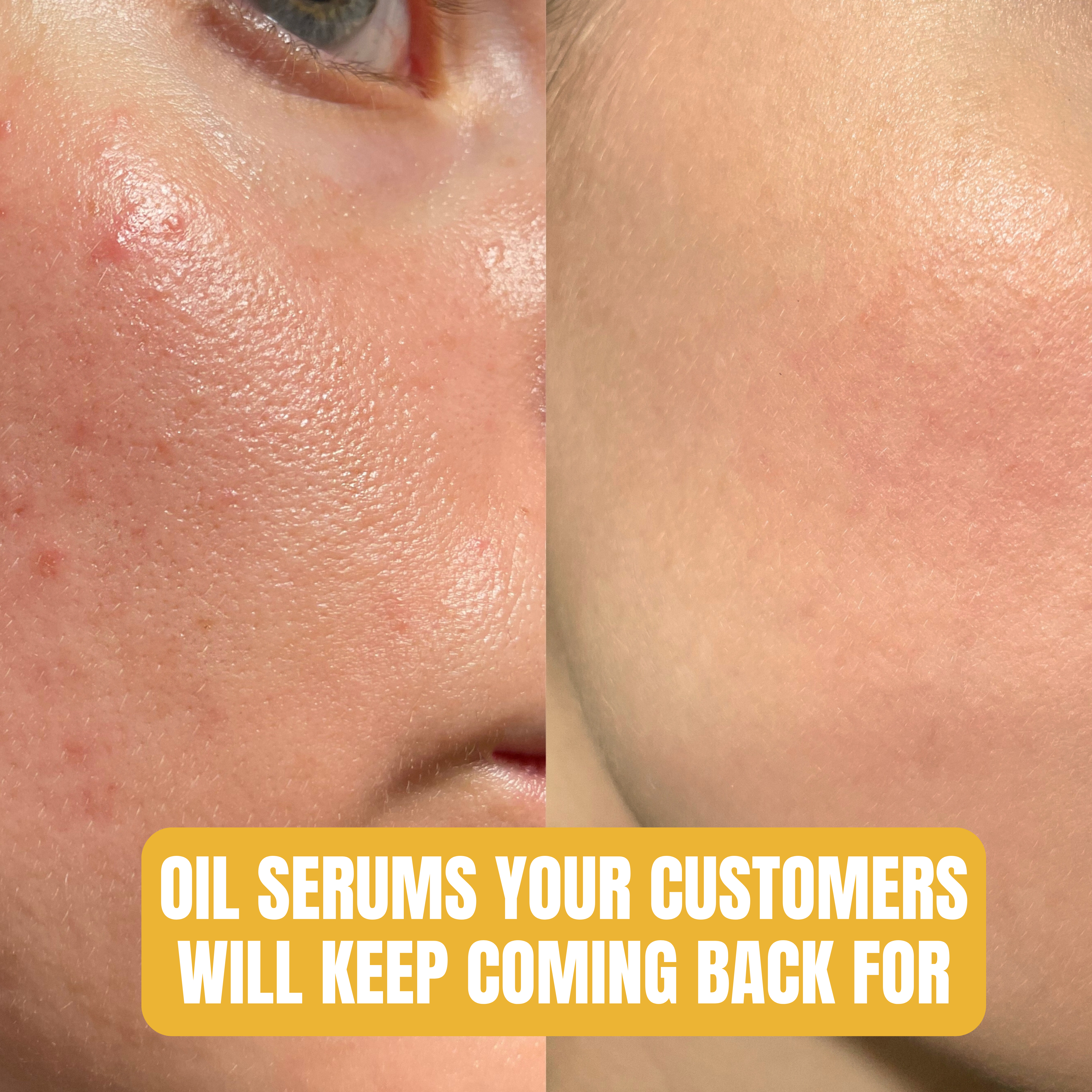 Botanical Oil Serum | Customizable